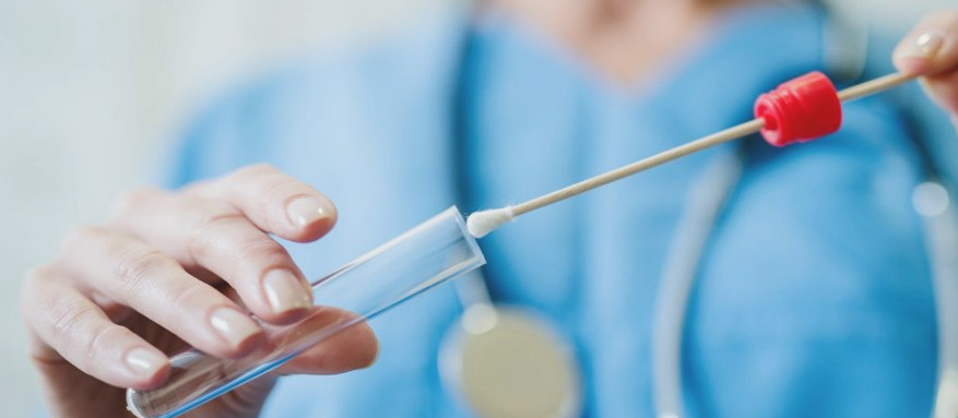 Al momento stai visualizzando Tamponi rapidi antigenici per il Covid-19