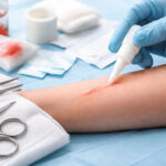 Colla per ferite: quale usare davvero, quando evitare l’Attack e cosa non mettere mai su una ferita