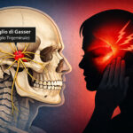Ganglio di Gasser, ganglio trigeminale e nevralgia del trigemino: sintomi, dolore, microcompressione e trattamenti